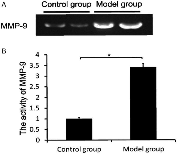 https://cdn.ncbi.nlm.nih.gov/pmc/blobs/7d5b/6124288/f6966de9c739/10.1177_0300060518774998-fig5.jpg