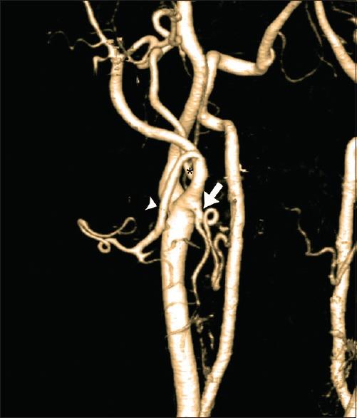 https://cdn.ncbi.nlm.nih.gov/pmc/blobs/7d5d/6896614/832724ad7dff/AJNS-14-1082-g005.jpg