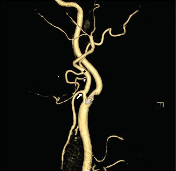 https://cdn.ncbi.nlm.nih.gov/pmc/blobs/7d5d/6896614/990bc2020ff2/AJNS-14-1082-g003.jpg