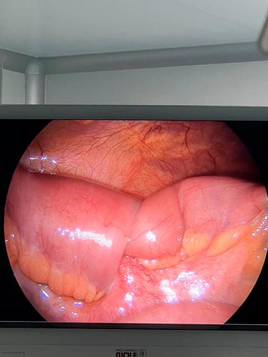 https://cdn.ncbi.nlm.nih.gov/pmc/blobs/7d5f/10205348/49f63219b025/ms9-85-1952-g001.jpg
