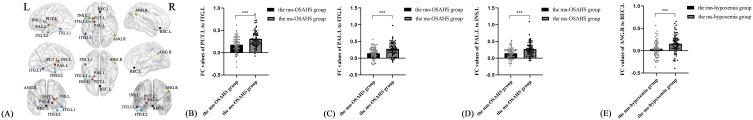 https://cdn.ncbi.nlm.nih.gov/pmc/blobs/7d5f/12034934/d51ffcfa622d/NSS-17-631-g0004.jpg