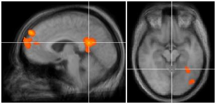 https://cdn.ncbi.nlm.nih.gov/pmc/blobs/7d67/3285156/4f386604762a/pone.0031248.g002.jpg