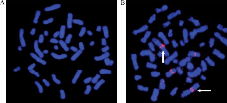 https://cdn.ncbi.nlm.nih.gov/pmc/blobs/7d69/3215221/9a5d80696477/NANO-1-5161-g009.jpg