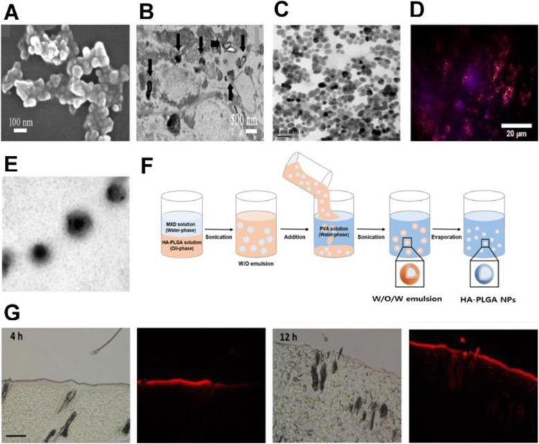 https://cdn.ncbi.nlm.nih.gov/pmc/blobs/7d6d/8317283/76ded3cb1e82/40824_2021_226_Fig3_HTML.jpg