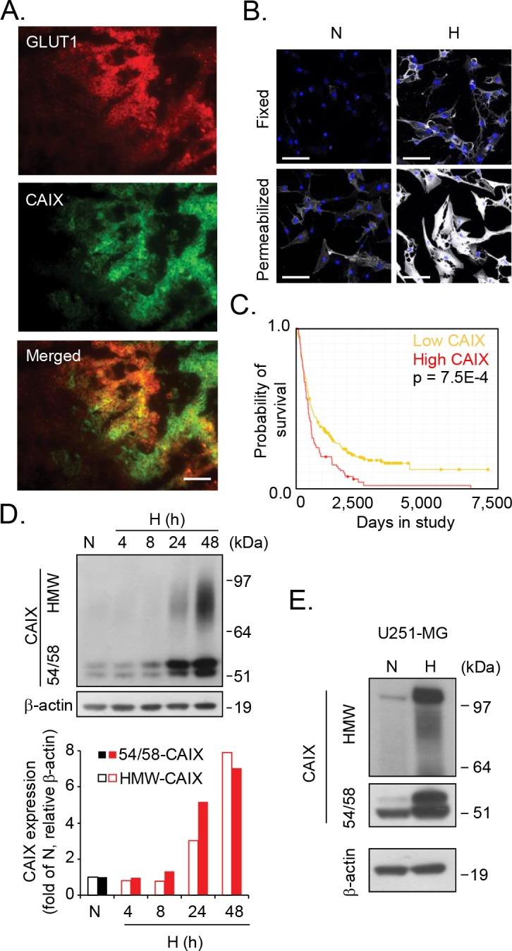 https://cdn.ncbi.nlm.nih.gov/pmc/blobs/7d76/5620149/2e3b53df6e00/oncotarget-08-66960-g001.jpg