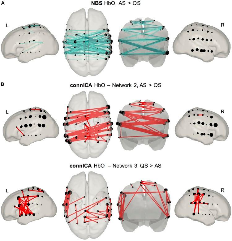 https://cdn.ncbi.nlm.nih.gov/pmc/blobs/7d7c/7180180/0762abb239ea/fnins-14-00347-g005.jpg