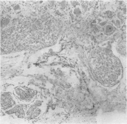 https://cdn.ncbi.nlm.nih.gov/pmc/blobs/7d7e/497230/22fdfdd52618/jnnpsyc00285-0033-b.jpg