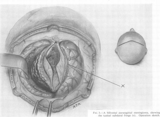 https://cdn.ncbi.nlm.nih.gov/pmc/blobs/7d7e/497230/efea433e57b4/jnnpsyc00285-0032-b.jpg