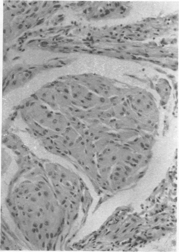 https://cdn.ncbi.nlm.nih.gov/pmc/blobs/7d7e/497230/fb2c549b62c6/jnnpsyc00285-0033-a.jpg