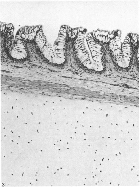 https://cdn.ncbi.nlm.nih.gov/pmc/blobs/7d80/1164381/6f37cdb5b9ca/janat00198-0144-b.jpg