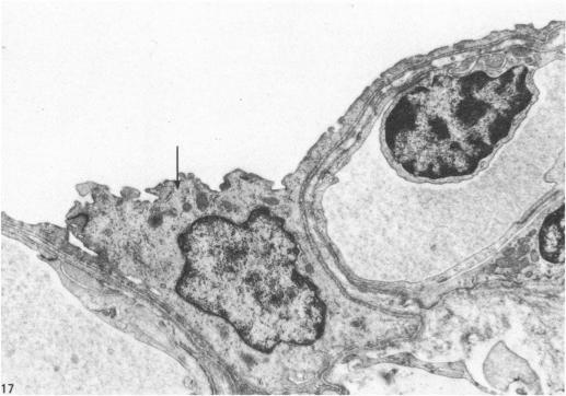 https://cdn.ncbi.nlm.nih.gov/pmc/blobs/7d80/1164381/755f149980dd/janat00198-0155-a.jpg
