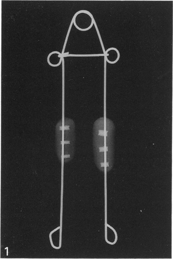 https://cdn.ncbi.nlm.nih.gov/pmc/blobs/7d81/1257128/a7ccfa4100a8/janat00039-0075-a.jpg