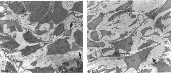 https://cdn.ncbi.nlm.nih.gov/pmc/blobs/7d81/1257128/c68fdc5875a3/janat00039-0080-b.jpg
