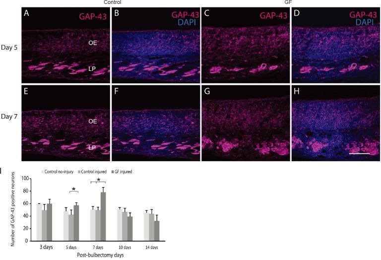 https://cdn.ncbi.nlm.nih.gov/pmc/blobs/7d87/6128065/d54ef0c0bc6d/NRR-13-1820-g003.jpg