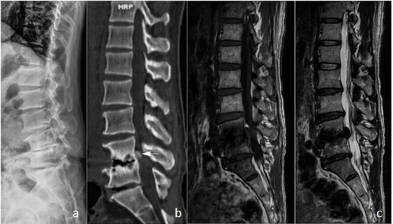 https://cdn.ncbi.nlm.nih.gov/pmc/blobs/7d8a/12143496/86c29158a02c/pone.0315153.g003.jpg