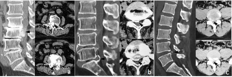 https://cdn.ncbi.nlm.nih.gov/pmc/blobs/7d8a/12143496/b3fd15c41fa5/pone.0315153.g001.jpg