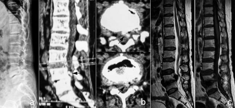 https://cdn.ncbi.nlm.nih.gov/pmc/blobs/7d8a/12143496/b836653339f3/pone.0315153.g006.jpg