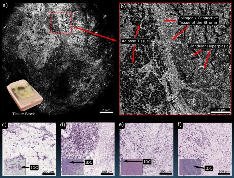 https://cdn.ncbi.nlm.nih.gov/pmc/blobs/7d8b/7644651/755197960d4e/41598_2020_76155_Fig4_HTML.jpg