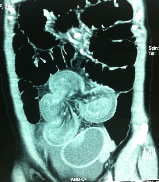 https://cdn.ncbi.nlm.nih.gov/pmc/blobs/7d8c/4643153/db9423f21892/PAMJ-22-6-g001.jpg
