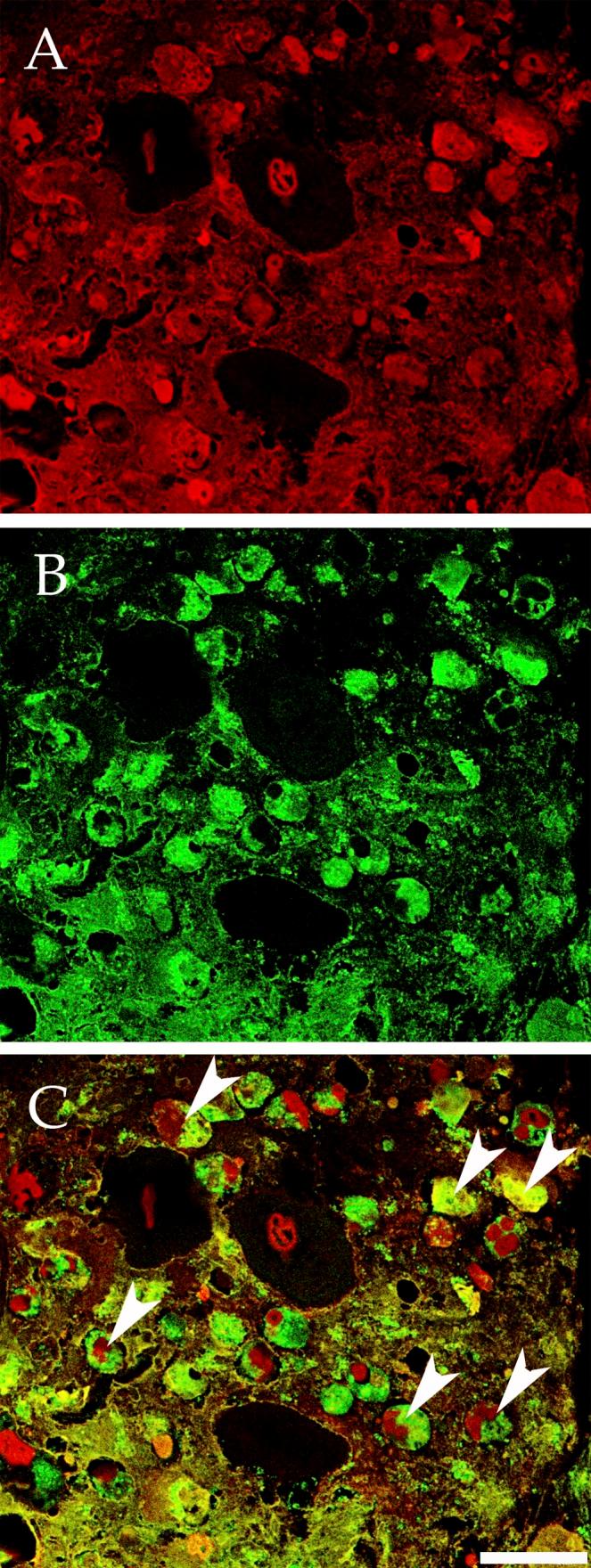 https://cdn.ncbi.nlm.nih.gov/pmc/blobs/7d8f/3432757/2b684aac2039/JCB_201203170_Fig5.jpg