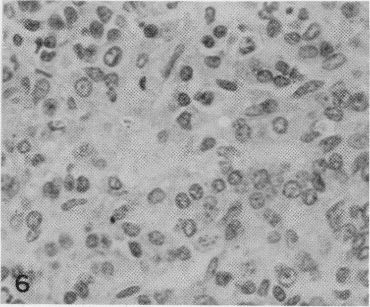 https://cdn.ncbi.nlm.nih.gov/pmc/blobs/7d90/2008535/29c1e1917b28/brjcancer00358-0181-f.jpg