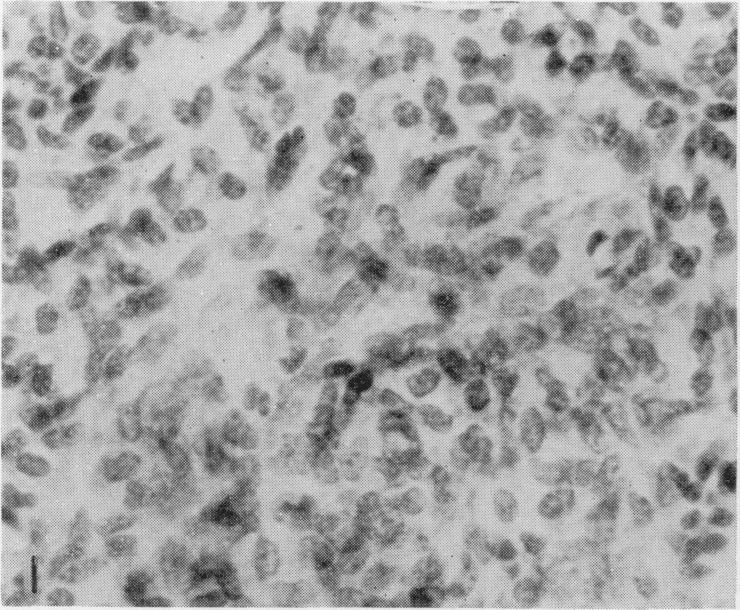 https://cdn.ncbi.nlm.nih.gov/pmc/blobs/7d90/2008535/2b48612f8ec8/brjcancer00358-0181-a.jpg