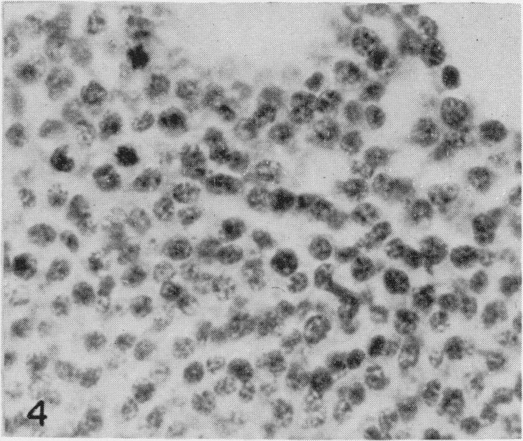 https://cdn.ncbi.nlm.nih.gov/pmc/blobs/7d90/2008535/7bfb36cfa904/brjcancer00358-0181-d.jpg