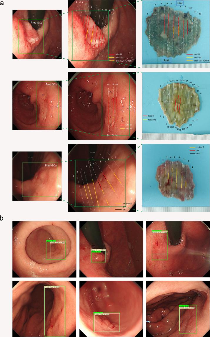 https://cdn.ncbi.nlm.nih.gov/pmc/blobs/7d96/7708824/2e75d4fbca46/gr3.jpg