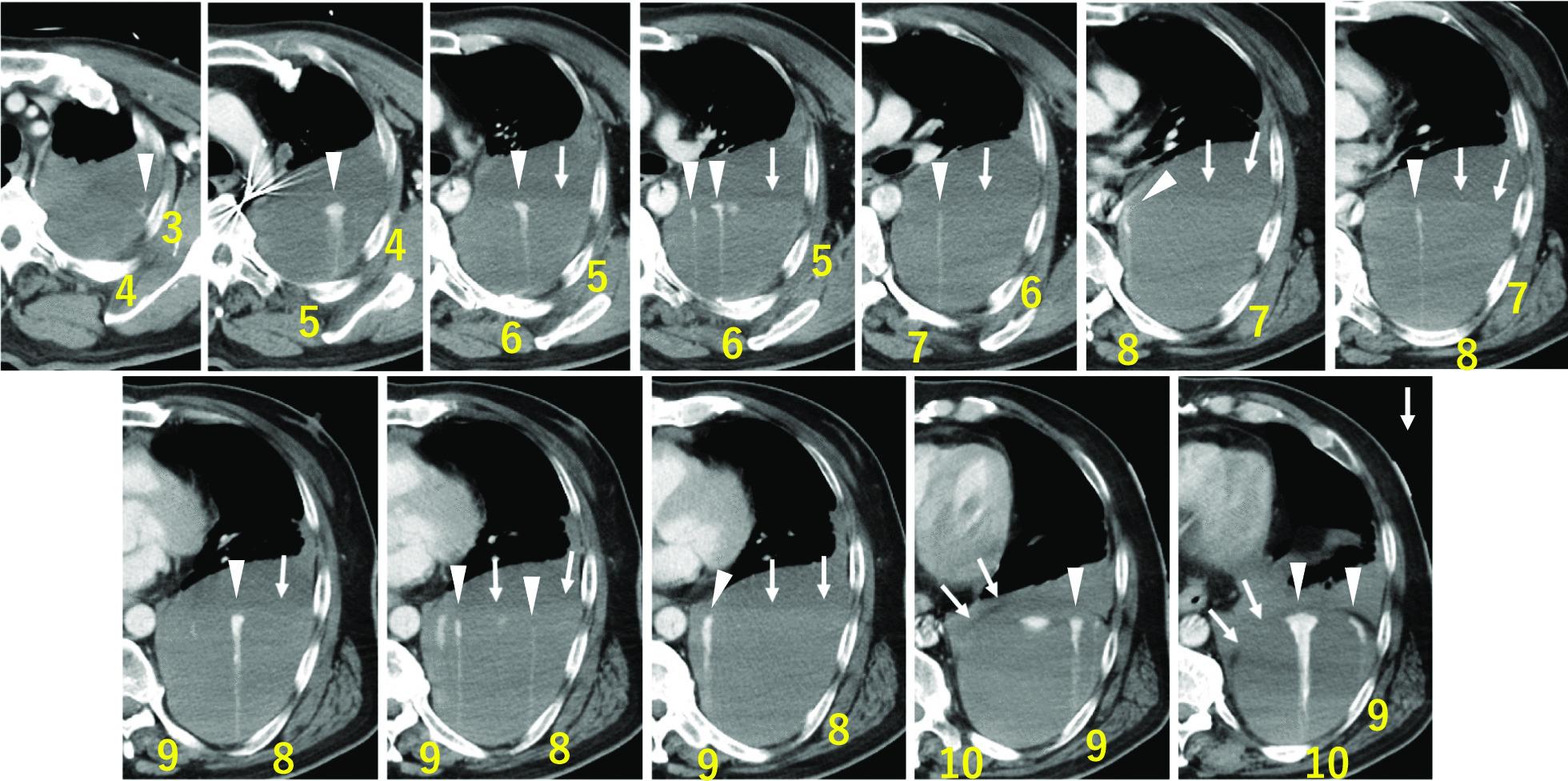 https://cdn.ncbi.nlm.nih.gov/pmc/blobs/7d97/11180386/f5a2de7f2ec0/13256_2024_4602_Fig1_HTML.jpg