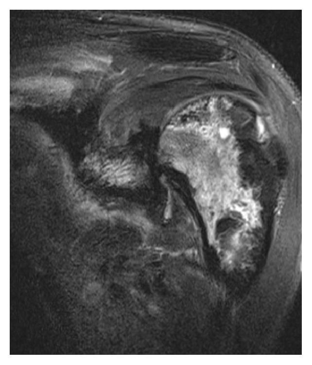 https://cdn.ncbi.nlm.nih.gov/pmc/blobs/7d99/4677016/43faaca2adc5/CRIRA2015-730719.007.jpg