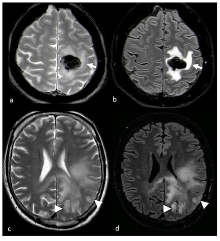 https://cdn.ncbi.nlm.nih.gov/pmc/blobs/7d9f/10252005/a78cc195e6e2/cancers-15-02992-g001.jpg