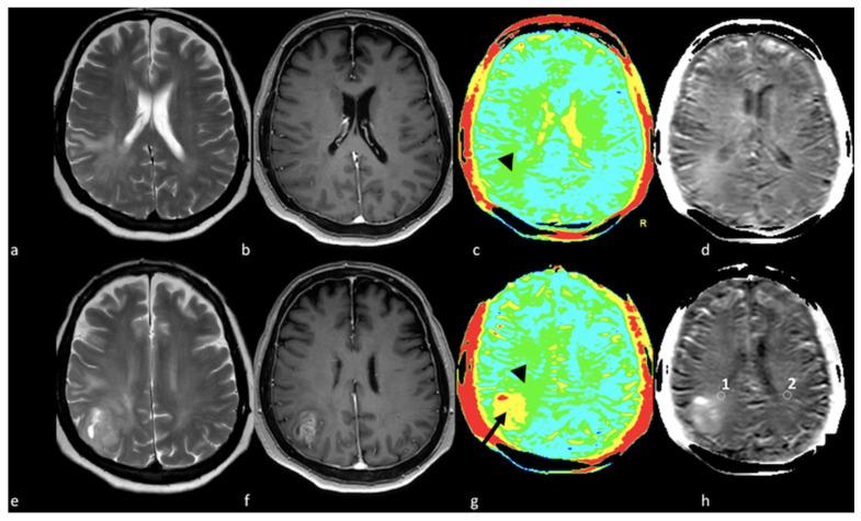 https://cdn.ncbi.nlm.nih.gov/pmc/blobs/7d9f/10252005/e444e531346c/cancers-15-02992-g012.jpg