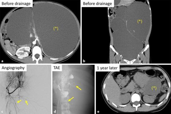 https://cdn.ncbi.nlm.nih.gov/pmc/blobs/7da5/5968287/51979aa1f546/cnd-0008-0082-g02.jpg