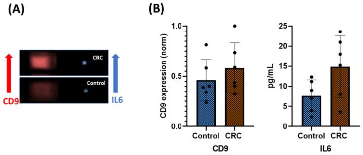 https://cdn.ncbi.nlm.nih.gov/pmc/blobs/7dae/10708636/b77f8ebd78c7/sensors-23-09432-g009.jpg