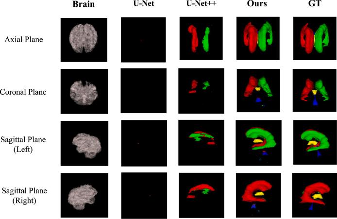 https://cdn.ncbi.nlm.nih.gov/pmc/blobs/7db3/8459787/622e5054ba51/gr19.jpg