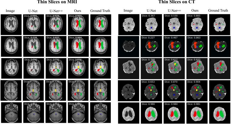 https://cdn.ncbi.nlm.nih.gov/pmc/blobs/7db3/8459787/be46247d733f/gr18.jpg