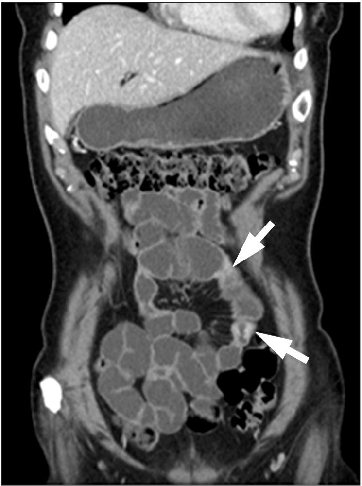 https://cdn.ncbi.nlm.nih.gov/pmc/blobs/7db7/4316223/742b62b0cd66/ir-13-6-g002.jpg
