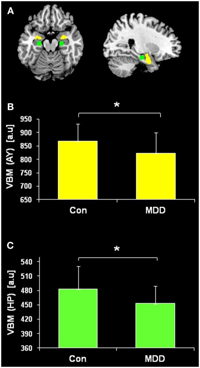 https://cdn.ncbi.nlm.nih.gov/pmc/blobs/7dbc/3787329/0a296776cbf0/fnhum-07-00639-g001.jpg