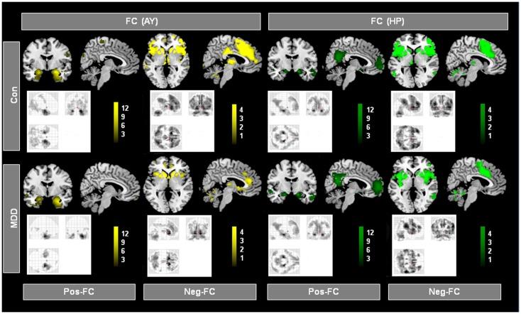 https://cdn.ncbi.nlm.nih.gov/pmc/blobs/7dbc/3787329/2b45ad4560b1/fnhum-07-00639-g002.jpg