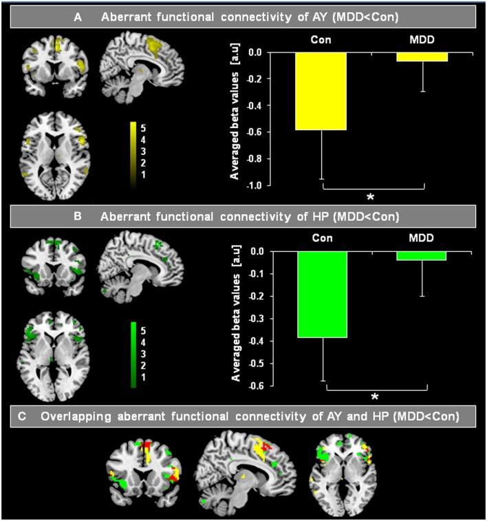 https://cdn.ncbi.nlm.nih.gov/pmc/blobs/7dbc/3787329/a39296817f5f/fnhum-07-00639-g003.jpg