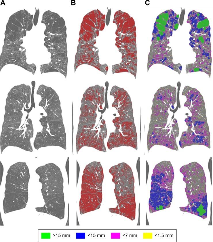 https://cdn.ncbi.nlm.nih.gov/pmc/blobs/7dc6/5516780/bcb14bc3abd4/copd-12-2043Fig2.jpg