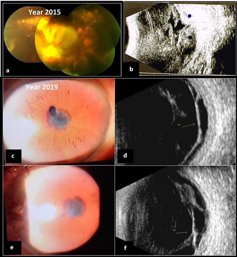 https://cdn.ncbi.nlm.nih.gov/pmc/blobs/7dcd/9294954/0455b76f0a9c/cop-0013-0490-g03.jpg
