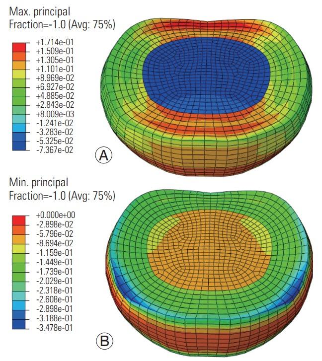 https://cdn.ncbi.nlm.nih.gov/pmc/blobs/7dd1/6147880/552798edf235/asj-2018-12-5-910f3.jpg