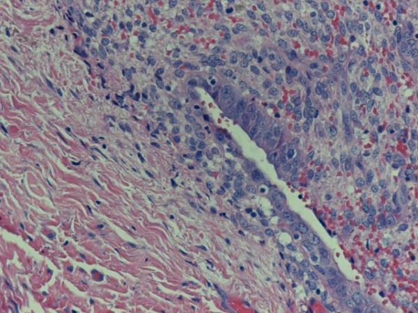 https://cdn.ncbi.nlm.nih.gov/pmc/blobs/7dd2/2803849/8d551db83f66/1752-1947-3-9326-1.jpg