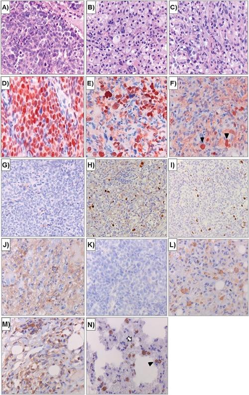 https://cdn.ncbi.nlm.nih.gov/pmc/blobs/7dd4/5656928/e3c76d212753/JMV-89-2207-g005.jpg