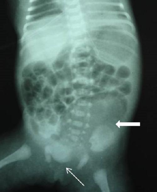 https://cdn.ncbi.nlm.nih.gov/pmc/blobs/7ddb/4715891/02982c061a7d/ajcr-7-9.f2.jpg