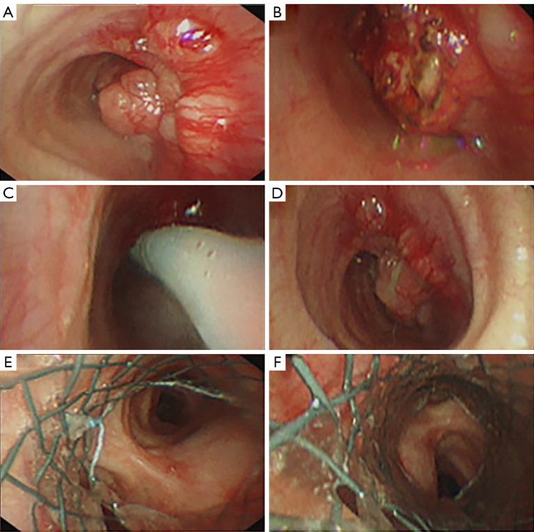 https://cdn.ncbi.nlm.nih.gov/pmc/blobs/7ddd/9459539/318eea4143d4/tcr-11-08-2946-f2.jpg