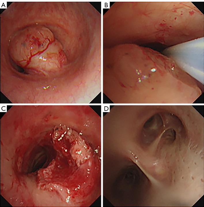https://cdn.ncbi.nlm.nih.gov/pmc/blobs/7ddd/9459539/8e24ae534e89/tcr-11-08-2946-f1.jpg