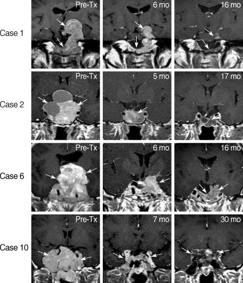 https://cdn.ncbi.nlm.nih.gov/pmc/blobs/7dde/2752771/caf215fb4118/jkms-24-874-g002.jpg
