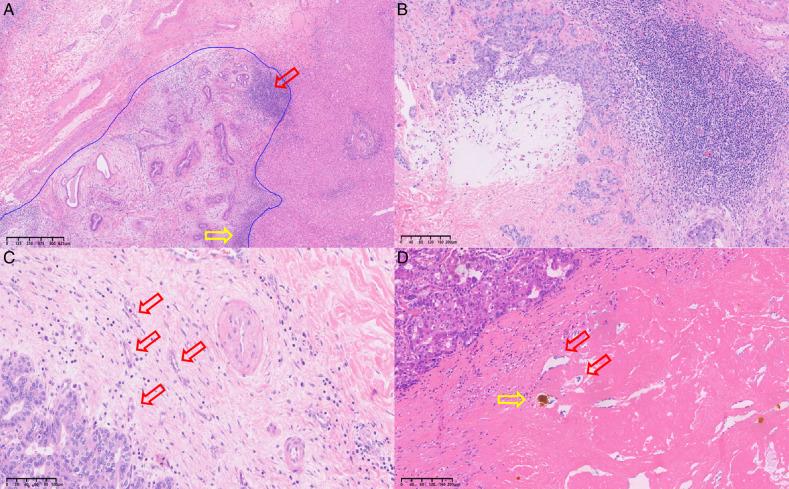 https://cdn.ncbi.nlm.nih.gov/pmc/blobs/7de6/12068548/a30d61838b40/pas-49-578-g001.jpg
